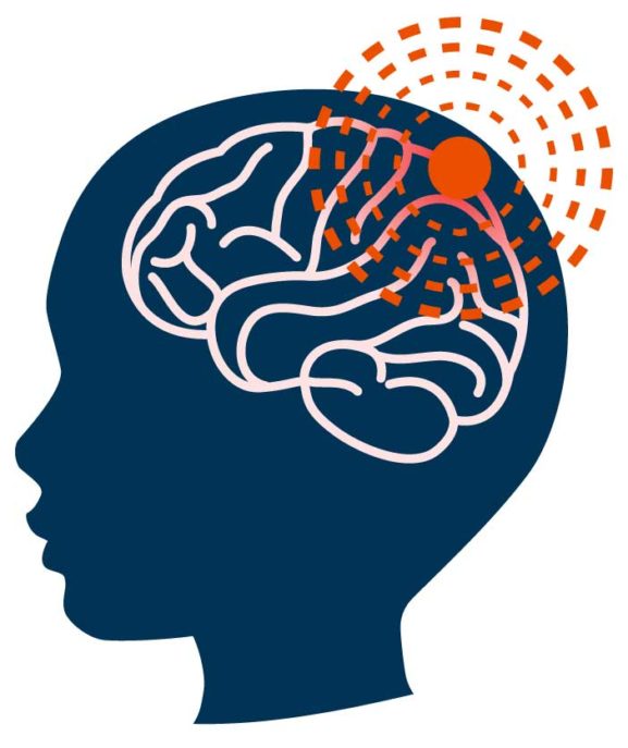 Meningitis in Infants | Causes, Symptoms & Treatment